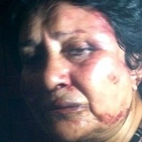 Ana Luisa Pardo Çıplak