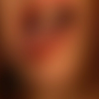 Daiga Korme Çıplak