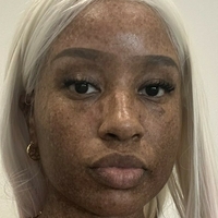 freckledn Çıplak