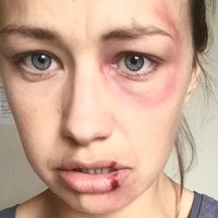 Lorna Dempsey Çıplak