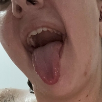 lyss98 Çıplak