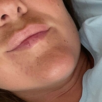 naughty_katarina_free Çıplak